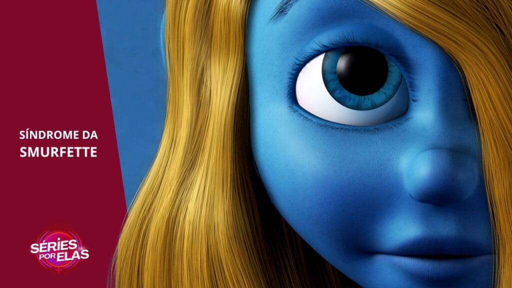 sindrome da smurfette
